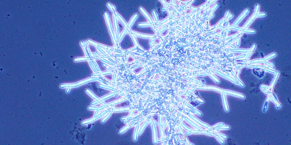 Mikroskopische Aufnahme von Aspergillus niger in Flüssigkultur