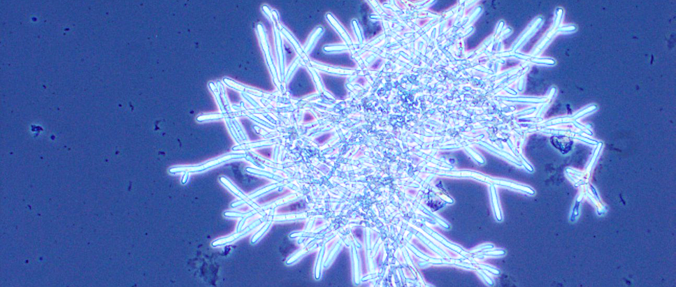 Mikroskopische Aufnahme von Aspergillus niger in Flüssigkultur