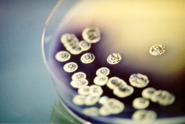 BRAIN AG: Mikroorganismen als chemische Fabriken im Mikromaßstab